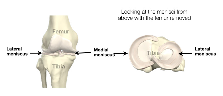 meniscus-img-1